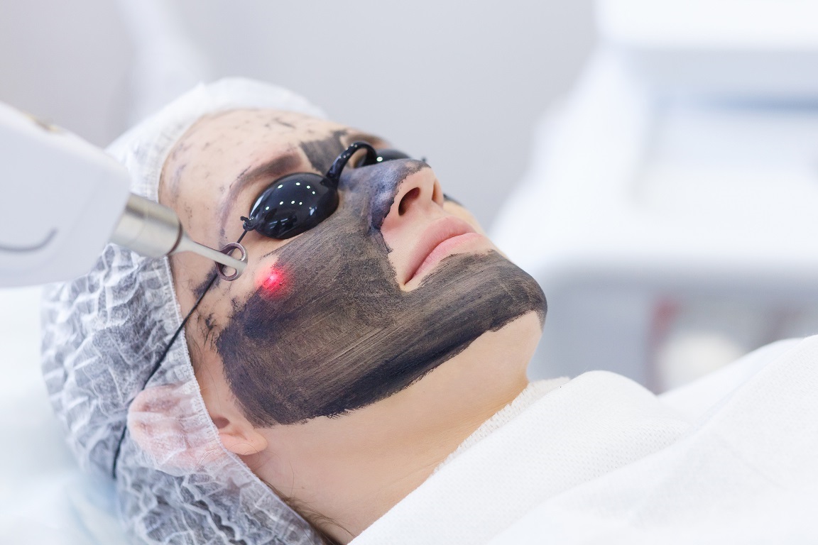 Carbon Facial